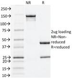 Estrogen Receptor, alpha (Marker of Estrogen Dependence) Antibody in SDS-PAGE (SDS-PAGE)