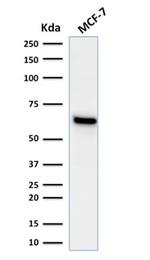 Estrogen Receptor, alpha (Marker of Estrogen Dependence) Antibody in Western Blot (WB)