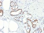 Estrogen Receptor, alpha (Marker of Estrogen Dependence) Antibody in Immunohistochemistry (Paraffin) (IHC (P))