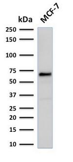 Estrogen Receptor, alpha (Marker of Estrogen Dependence) Antibody in Western Blot (WB)