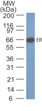 Estrogen Receptor, alpha (Marker of Estrogen Dependence) Antibody in Western Blot (WB)