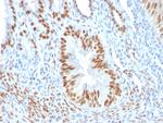 Estrogen Receptor, alpha (Marker of Estrogen Dependence) Antibody in Immunohistochemistry (Paraffin) (IHC (P))