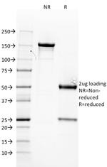 Estrogen Receptor, alpha (Marker of Estrogen Dependence) Antibody in SDS-PAGE (SDS-PAGE)