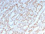 Estrogen Receptor, alpha (Marker of Estrogen Dependence) Antibody in Immunohistochemistry (Paraffin) (IHC (P))