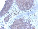 Estrogen Receptor, alpha (Marker of Estrogen Dependence) Antibody in Immunohistochemistry (Paraffin) (IHC (P))