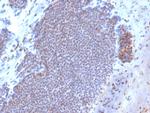 Estrogen Receptor, alpha (Marker of Estrogen Dependence) Antibody in Immunohistochemistry (Paraffin) (IHC (P))