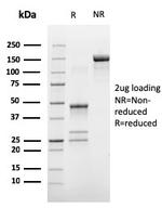 Estrogen Receptor, alpha (Marker of Estrogen Dependence) Antibody in SDS-PAGE (SDS-PAGE)