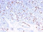 Estrogen Receptor, alpha (Marker of Estrogen Dependence) Antibody in Immunohistochemistry (Paraffin) (IHC (P))