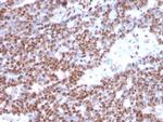 Estrogen Receptor, alpha (Marker of Estrogen Dependence) Antibody in Immunohistochemistry (Paraffin) (IHC (P))