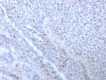 Estrogen Receptor, alpha (Marker of Estrogen Dependence) Antibody in Immunohistochemistry (Paraffin) (IHC (P))