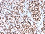 Estrogen Receptor, alpha (Marker of Estrogen Dependence) Antibody in Immunohistochemistry (Paraffin) (IHC (P))