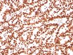 Estrogen Receptor, alpha (Marker of Estrogen Dependence) Antibody in Immunohistochemistry (Paraffin) (IHC (P))