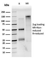 Estrogen Receptor, alpha (Marker of Estrogen Dependence) Antibody in SDS-PAGE (SDS-PAGE)