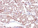 Estrogen Receptor, alpha (Marker of Estrogen Dependence) Antibody in Immunohistochemistry (Paraffin) (IHC (P))