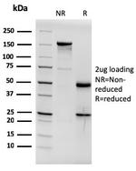 Estrogen Receptor, alpha (Marker of Estrogen Dependence) Antibody in SDS-PAGE (SDS-PAGE)