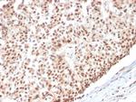 Estrogen Receptor, alpha (Marker of Estrogen Dependence) Antibody in Immunohistochemistry (Paraffin) (IHC (P))