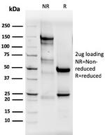 Estrogen Receptor, alpha (Marker of Estrogen Dependence) Antibody in SDS-PAGE (SDS-PAGE)