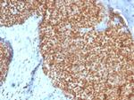 Estrogen Receptor, alpha (Marker of Estrogen Dependence) Antibody in Immunohistochemistry (Paraffin) (IHC (P))