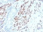 Estrogen Receptor, alpha (Marker of Estrogen Dependence) Antibody in Immunohistochemistry (Paraffin) (IHC (P))