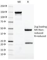 Estrogen Receptor (Marker of Estrogen Dependence) Antibody in SDS-PAGE (SDS-PAGE)