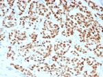 Estrogen Receptor, alpha (Marker of Estrogen Dependence) Antibody in Immunohistochemistry (Paraffin) (IHC (P))