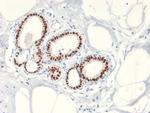 Estrogen Receptor, alpha (Marker of Estrogen Dependence) Antibody in Immunohistochemistry (Paraffin) (IHC (P))