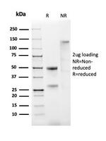 Estrogen Receptor, alpha (Marker of Estrogen Dependence) Antibody in SDS-PAGE (SDS-PAGE)