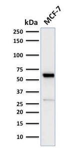 Estrogen Receptor, alpha (Marker of Estrogen Dependence) Antibody in Western Blot (WB)