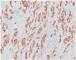 Estrogen Receptor, alpha (Marker of Estrogen Dependence) Antibody in Immunohistochemistry (Paraffin) (IHC (P))