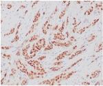 Estrogen Receptor, alpha (Marker of Estrogen Dependence) Antibody in Immunohistochemistry (Paraffin) (IHC (P))