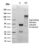 Estrogen Receptor, alpha (Marker of Estrogen Dependence) Antibody in SDS-PAGE (SDS-PAGE)