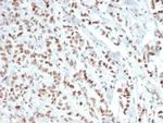 Estrogen Receptor, alpha (Marker of Estrogen Dependence) Antibody in Immunohistochemistry (Paraffin) (IHC (P))