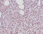 Estrogen Receptor, alpha (Marker of Estrogen Dependence) Antibody in Immunohistochemistry (Paraffin) (IHC (P))