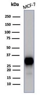 Estrogen Receptor, alpha (Marker of Estrogen Dependence) Antibody in Western Blot (WB)