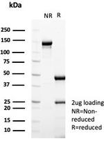 Estrogen Receptor, alpha (Marker of Estrogen Dependence) Antibody in SDS-PAGE (SDS-PAGE)