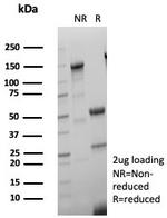 Estrogen Receptor, alpha (Marker of Estrogen Dependence) Antibody in SDS-PAGE (SDS-PAGE)