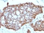 ER-beta-1 (Estrogen Receptor beta-1) Antibody in Immunohistochemistry (Paraffin) (IHC (P))