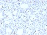 ER-beta (Estrogen Receptor beta-5) Antibody in Immunohistochemistry (Paraffin) (IHC (P))