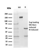 ER-beta (Estrogen Receptor beta-5) Antibody in SDS-PAGE (SDS-PAGE)