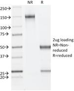 ER-beta-1 (Estrogen Receptor beta-1) Antibody in SDS-PAGE (SDS-PAGE)