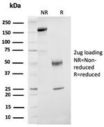 ER-beta-1 (Estrogen Receptor beta-1) Antibody in SDS-PAGE (SDS-PAGE)