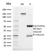 Albumin (Transport Protein) Antibody in SDS-PAGE (SDS-PAGE)