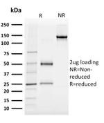 Albumin (Transport Protein) Antibody in SDS-PAGE (SDS-PAGE)