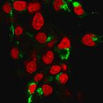 Albumin (Transport Protein) Antibody in Immunocytochemistry (ICC/IF)