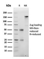 Albumin (Transport Protein) Antibody in SDS-PAGE (SDS-PAGE)