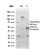 Albumin (Transport Protein) Antibody in SDS-PAGE (SDS-PAGE)