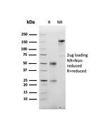 Albumin (Transport Protein) Antibody in SDS-PAGE (SDS-PAGE)