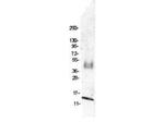 MIP-1 beta Antibody in Western Blot (WB)