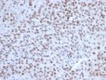 EZH2/KMT6 Antibody in Immunohistochemistry (Paraffin) (IHC (P))