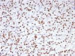 EZH2/KMT6 Antibody in Immunohistochemistry (Paraffin) (IHC (P))